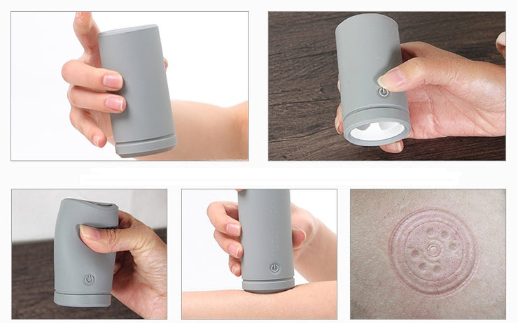 Cupping Therapy Massager | Electric Cup Massager | WorldTechGadgets